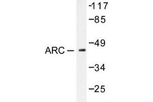Image no. 2 for anti-Cadherin 1, Type 1, E-Cadherin (Epithelial) (CDH1) (Arg3) antibody (ABIN265314) (E-cadherin antibody  (Arg3))