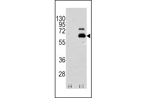 Western blot analysis of RPS6KB1 (arrow) using rabbit polyclonal RPS6KB1 Antibody  (R). (RPS6KB1 antibody  (AA 405-434))