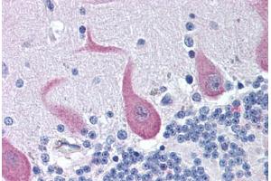 Human Brain, Cerebellum (formalin-fixed, paraffin-embedded) stained with FAIM2 antibody ABIN292115 at 10 ug/ml followed by biotinylated goat anti-rabbit IgG secondary antibody ABIN481713, alkaline phosphatase-streptavidin and chromogen. (FAIM2 antibody  (AA 1-50))