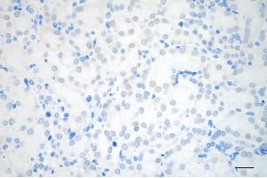 Immunohistochemistry was performed on paraffin-embedded mouse kidney using chromodomain helicase DNA binding protein 3 antibody (ABIN7798069), 1:200). (Recombinant CHD3 antibody)