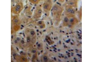 #VALUE! (NAMPT antibody  (AA 1-491))