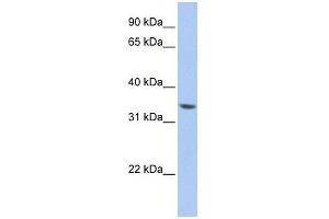 ZNF584 antibody used at 0.