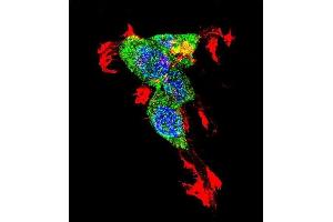 Confocal immunofluorescent analysis of CTNNB1 Antibody (N-term) with 293 cell followed by Alexa Fluor 488-conjugated goat anti-rabbit lgG (green). (CTNNB1 antibody  (N-Term))