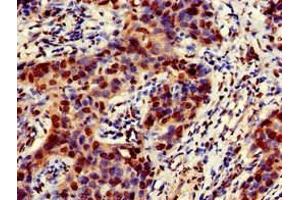 Immunohistochemistry (IHC) image for anti-Emerin (EMD) (AA 1-222) antibody (ABIN7151606)