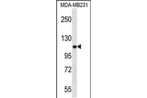 Western blot analysis in MDA-MB231 cell line lysates (35ug/lane). (ACTN3 antibody  (AA 409-437))