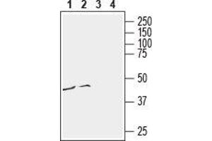 Western blot analysis of human malignant melanoma cell line Malme-3M (lanes 1 and 3) and human monocytic leukemia THP-1 cell line (lanes 2 and 4) lysates: - 1,2. (CCR3 antibody  (Extracellular))