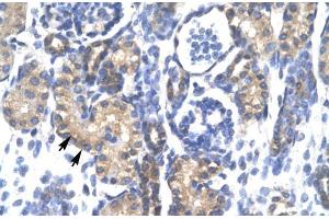 Human kidney; PSMC3 antibody - middle region in Human kidney cells using Immunohistochemistry