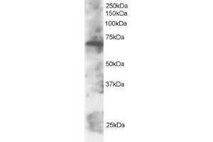 Western Blotting (WB) image for anti-SWAP Switching B-Cell Complex 70kDa Subunit (SWAP70) (C-Term) antibody (ABIN2466338) (SWAP70 antibody  (C-Term))