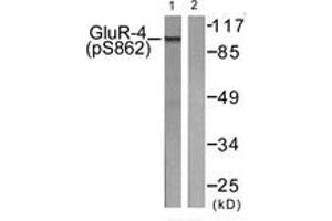 Western blot analysis of extracts from HepG2 cells treated with Forskolin 40nM 30', using GluR4 (Phospho-Ser862) Antibody. (GRIA4 antibody  (pSer862))