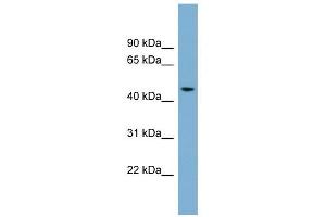 ACTR3B antibody used at 1 ug/ml to detect target protein. (ACTR3B antibody)