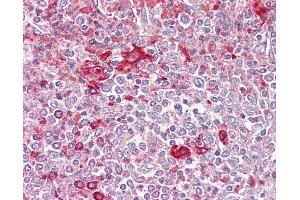 Anti-TLR5 antibody IHC of human spleen. (TLR5 antibody  (AA 300-350))