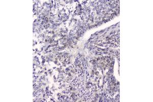 IHC analysis of HSPA2 using anti-HSPA2 antibody (ABIN5692870).