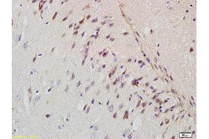 Formalin-fixed and paraffin embedded rat brain labeled with Rabbit Anti-APP/Amyloid Precursor Protein Polyclonal Antibody (ABIN725120) at 1:200 followed by conjugation to the secondary antibody and DAB staining. (APP antibody  (AA 381-480))