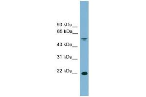 WB Suggested Anti-HDGFRP3 Antibody Titration: 0. (HDGFRP3 antibody  (Middle Region))