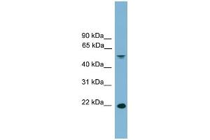 WB Suggested Anti-HDGFRP3 Antibody Titration: 0.