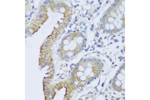 Immunohistochemistry of paraffin-embedded human colon using CRA antibody (ABIN6132087, ABIN6138999, ABIN6139001 and ABIN6217973) at dilution of 1:150 (40x lens). (EFCAB4B antibody  (AA 1-200))