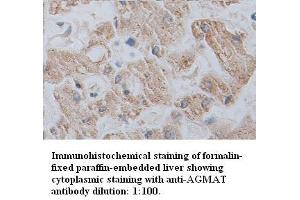 Image no. 1 for anti-Agmatine Ureohydrolase (Agmatinase) (AGMAT) antibody (ABIN1574528) (AGMAT antibody)