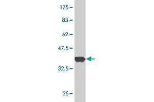 Western Blot detection against Immunogen (37. (STBD1 antibody  (AA 101-200))