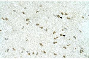Human Brain (RNF168 antibody  (C-Term))
