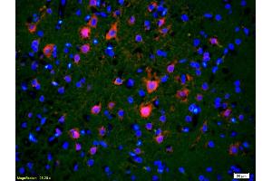 Formalin-fixed and paraffin-embedded rat brain labeled with Anti-APH1a Polyclonal Antibody, Unconjugated (ABIN706016) 1:200, overnight at 4°C, The secondary antibody was Goat Anti-Rabbit IgG, Cy3 conjugated used at 1:200 dilution for 40 minutes at 37°C. (APH1A antibody  (AA 71-170))