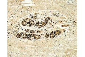 Immunohistochemistry (IHC) image for anti-Receptor Tyrosine-Protein Kinase ErbB-3 (ERBB3) (AA 24-55) antibody (ABIN3029524)
