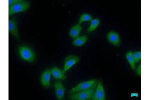 Immunofluorescence staining of HepG2 cells with ABIN7155164 at 1:50, counter-stained with DAPI. (PDE8A antibody  (AA 596-829))