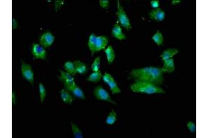 Immunofluorescence staining of Hela cells with ABIN7173795 at 1:333, counter-stained with DAPI. (TWEAK antibody  (AA 43-149))