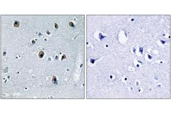 COL20A1 antibody  (AA 1151-1200)