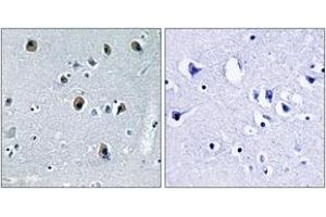 Immunohistochemistry analysis of paraffin-embedded human brain tissue, using Collagen XX alpha1 Antibody. (COL20A1 antibody  (AA 1151-1200))