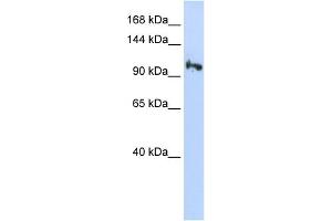 WB Suggested Anti-SMG5 Antibody Titration: 0. (SMG5 antibody  (N-Term))