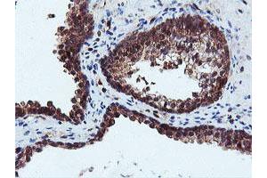 Image no. 1 for anti-Dual Specificity Phosphatase 23 (DUSP23) antibody (ABIN1497930) (DUSP23 antibody)