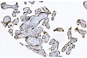 IHC analysis of PIWIL4/PIWI using anti-PIWIL4/PIWI antibody (ABIN7601940). (PIWIL4 antibody  (AA 51-749))