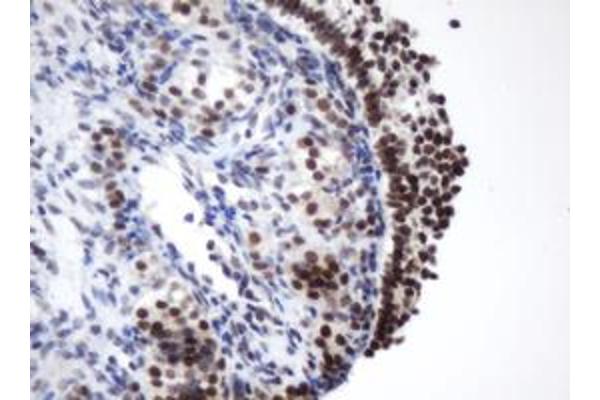 METTL16 antibody
