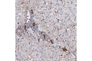 Immunohistochemical staining of human liver with ACTN4 polyclonal antibody  shows strong cytoplasmic and membranous positivity in lymphoid tissue in bile duct cells at 1:1000-1:2500 dilution. (alpha Actinin 4 antibody)
