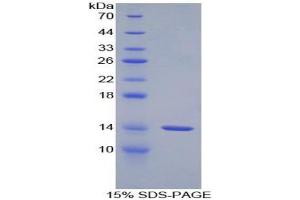 SDS-PAGE analysis of Rat GnRH Protein. (GNRH1 Protein)