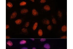 Immunofluorescence analysis of U-2 OS cells using RPP38 Polyclonal Antibody at dilution of 1:100.
