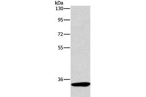 Western Blot analysis of Mouse kidney tissue using NCR1 Polyclonal Antibody at dilution of 1:450 (NCR1 antibody)