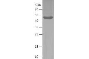 Western Blotting (WB) image for Kallikrein 8 (KLK8) (AA 33-260) protein (His-IF2DI Tag) (ABIN7283652) (Kallikrein 8 Protein (KLK8) (AA 33-260) (His-IF2DI Tag))