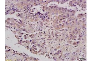 Formalin-fixed and paraffin embedded rat kidney labeled with Anti-FPR1 Polyclonal Antibody, Unconjugated (ABIN742245) at 1:200 followed by conjugation to the secondary antibody and DAB staining (FPR1 antibody)