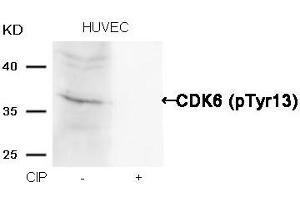Western blot analysis of extracts from HUVEC cells, treated with calf intestinal phosphatase (CIP), using CDK6 (phospho-Tyr13) Antibody. (CDK6 antibody  (pTyr13))