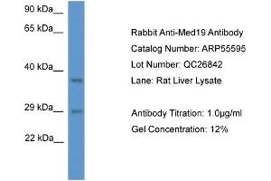Western Blotting (WB) image for anti-Mediator Complex Subunit 19 (MED19) (N-Term) antibody (ABIN2786281) (MED19 antibody  (N-Term))