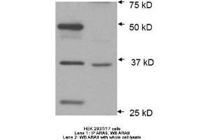 Image no. 2 for anti-Aryl Hydrocarbon Receptor Interacting Protein (AIP) antibody (ABIN363261) (AIP antibody)