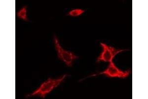 ABIN6275526 staining NIH-3T3 cells by IF/ICC. (SPINK5 antibody  (N-Term))