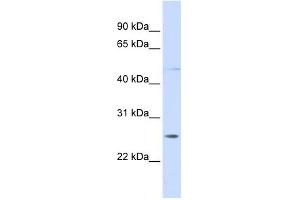 RNF170 antibody used at 1 ug/ml to detect target protein. (RNF170 antibody  (C-Term))