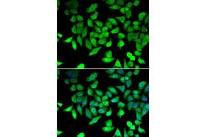 Immunofluorescence analysis of U2OS cells using CCAR2 antibody. (CCAR2 antibody)
