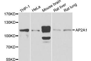 Western blot analysis of extracts of various cell lines, using AP2A1 antibody (ABIN5975765) at 1/1000 dilution. (alpha Adaptin antibody)