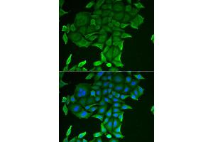 Immunofluorescence analysis of HeLa cell using CD84 antibody. (CD84 antibody)