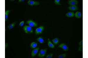 Immunofluorescence staining of A549 cells with ABIN7158892 at 1:166, counter-stained with DAPI. (MPEG1 antibody  (AA 537-633))