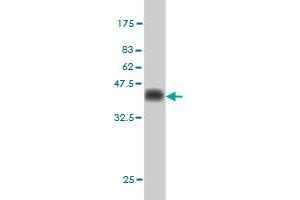 Western Blot detection against Immunogen (36. (CDX4 antibody  (AA 71-170))