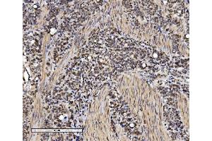 IHC analysis of VPRBP/DCAF1 using anti-VPRBP/DCAF1 antibody (ABIN7599063). (DDB1 and CUL4-Associated Factor 1 (DCAF1) (AA 1-195) antibody)